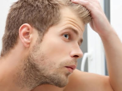 10راه برای جلوگیری از ریزش مو در مردان